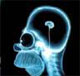 x-Ray Homer